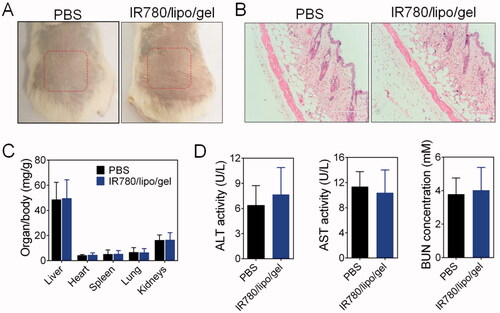 Figure 6. Safety of IR780/lipo/gel. (A) Skin morphology after topically application of IR780/lipo/gel. (B) The skin sections were further examined after H&E staining. (C) Weight ratios of organs to the total body weight and (D) quantification of ALT, AST, and BUN in the plasma after treatment with IR780/lipo/gel.