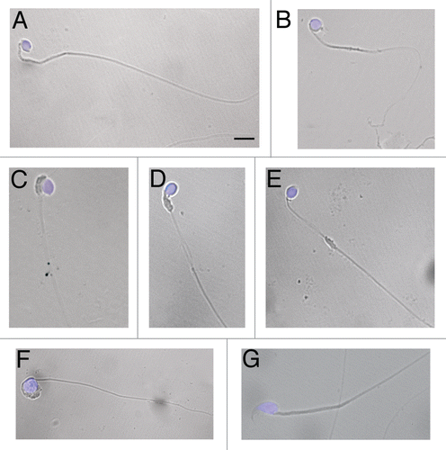 Figure 1 Morphology of wr spermatozoa. Spermatozoa were collected from the cauda epididymes of 35 days-old wr (A–F) and wild-type (G) mice. Nuclei were counterstained with DAPI. Note the rounded (globic, (A–E) and globoid, (F)) heads lacking an acrosome and the deformed, mislocalized mitochondrial sheath (C–E) of the wr sperm. Scale bar, 5 µm.