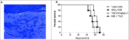 Figure 1. Highly invasive radiation and chemotherapy resistant glioma. (A) KR158B intracranial glioma is a highly invasive intracranial glioma that forms glioma islands and closely resembles primary human glioma. Shown is H&E stain of formalin-fixed, paraffin-embedded section (7 micron) taken from mice with established tumor. (B) Treatment with standard therapy with either whole brain radiation therapy (WBRT) or Temozolomide (TMZ) did not provide a survival benefit; however, the combination of WBRT+TMZ provided a modest increase in median survival, 38 d vs. 43 d, p = 0.0389 Gehan–Breslow–Wilcoxon test.