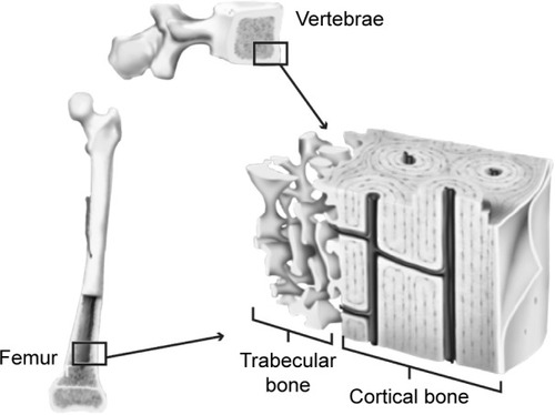 Figure 1 Structure of trabecular (spongy) and cortical (compact) bone tissue.