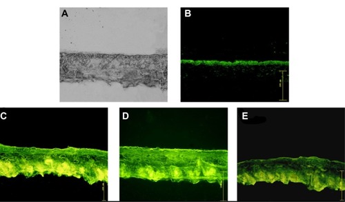 Figure 9 (A) Original microscopic image and (B–E) fluorescence images of mouse skin after a 2-hour diffusion of (B) free FITC-rhEGF, (C) FITC-rhEGF liposomes before drying, and FITC-rhEGF liposomal dry powders prepared with (D) USFD and (E) lyophilization.Abbreviations: FITC, fluorescein isothiocyanate; rhEGF, recombinant human epithelial growth factor; USFD, ultrasonic spray freeze-drying.