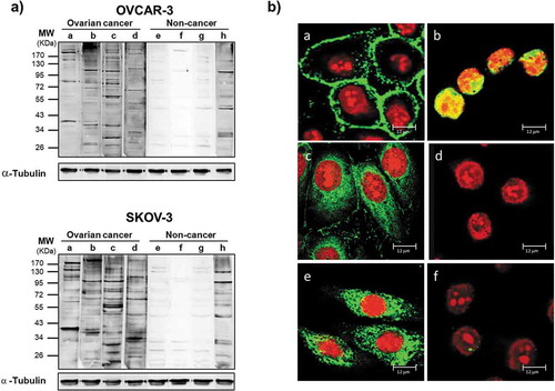 Figure 2. Antibodies from OC ascitic fluids react with tumor cells.(a) Western blot of lysates from OVCAR-3 (upper panel) and SKOV-3 (lower panel) cells. Each sample was incubated with equal amount of Igs purified from ascites from OC patients (a-d) or from noncancerous controls (e-h). Immunoreactivity was detected with HRP-conjugated anti-human secondary antibody. After detection of ascitic IgG immunoreactivity, the membranes were stripped and probed with anti-α-tubulin antibody to assess the loading of lysate among the samples. (b) Immunofluorescence of OVCAR-3 and SKOV-3 cells with Igs purified from ascites. The cellular localization of TAAs was detected with Cy5-conjugated anti-human IgG (green). Nuclei were stained with propidium iodide (red). (a-d) Representative images of OVCAR-3 cells incubated with (a-c) Igs from OC ascites (a) without cell permeabilization, showing surface staining; (b) after cell fixation, showing nuclear staining; and (c) after permeabilization, showing cytoplasmic staining; (d) image of fixed and permeabilized OVCAR-3 cells incubated with Igs from noncancerous controls, showing a lack of any detectable signal. (e, f) Immunofluorescence analysis of fixed and permeabilized SKOV-3 cells incubated with Igs from ascites from patients with (e) OC and (f) noncancerous conditions, confirming the difference in reactivity.