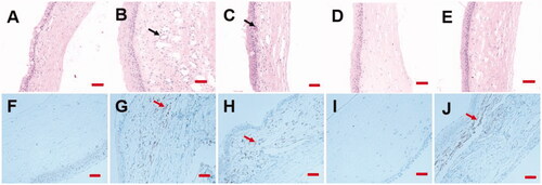 Figure 8. Effects of resveratrol on corneal epidermal recovery. H&E images of corneal tissues in the healthy group (A), the control group (B), the RHS group (C), the ROLG group (D), and the blank LCG group (E). Black arrows indicate neovascularization. Immunohistochemistry analysis of VEGF expression in the healthy group (F), the control group (G), the RHS group (H), the ROLG group (I), and the blank LCG group (J). Red arrows represent VEGF expression in the corneal tissues. Scale bars indicate 100 μm.