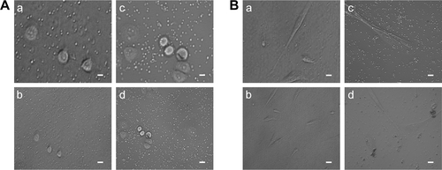 Figure S2 (A) Platelet aggregation of platelets co-cultured with SGC-7901 cells for 0 hours (a, b) and 2 hours (c, d) was photographed by microscope. (B) Platelet aggregation of platelets co-cultured with BM-MSCs for 0 hours (a, b) and 2 hours (c, d) was photographed by microscope. The magnification of a and c is ×400 (scale bar: 10 µm) and the magnification of b and d is ×200 (scale bar: 20 µm).