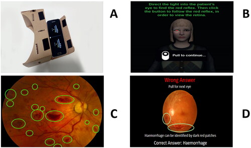 Figure 1. Examples of the VR app and educational scenes [A] app, phone and Google CardboardTM, [B] red reflex, [C] haemorrhage and [D] quiz.