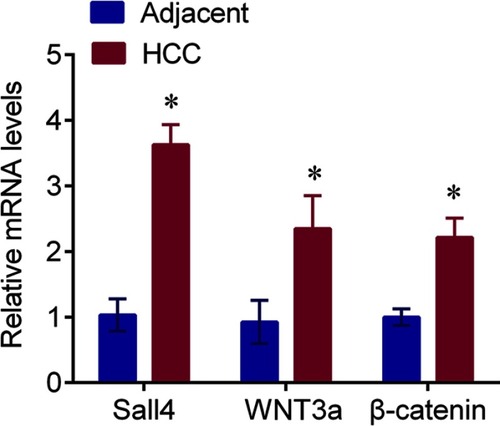 Figure 2 The Sall4, WNT3a and β-catenin mRNA expressions in HCC and adjacent normal tissues; *P<0.05 vs adjacent control.Abbreviations: HCC, hepatocellular carcinoma; Sall4, Spalt-Like Transcription Factor 4.