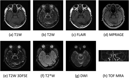 Figure 4. Typical clinical MR images of the author’s brain acquired at 3 T in 2019. The pulse sequences were (a) T1 weighted fast spin echo (FSE) (TR/TE = 550 ms/8.7 ms), (b) T2 weighted FSE (TR/TE = 5272 ms/103 ms), (c) Fluid attenuated inversion recovery (FLAIR) (TR/TI/TE = 8000 ms/2348 ms/143 ms), (d) Magnetization prepared rapid gradient echo (MPRAGE) (TR/TI/TE/FA = 8000 ms/1873 ms/2.88 ms/6°), (e) T2 weighted 3D FSE (TR/TE = 2252 ms/110 ms), (f) T2* weighted gradient echo (TR/TE/FA = 30 ms/20.34 ms/5°), (g) diffusion weighted imaging (TR/TE = 3000 ms/80 ms, b = 1000), and (h) time of flight MR angiography (TR/TE/FA = 20 ms/3.4 ms/18°)