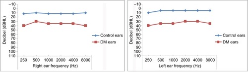 Figure 1 The audiogram of mean hearing thresholds of DM patients and controls.