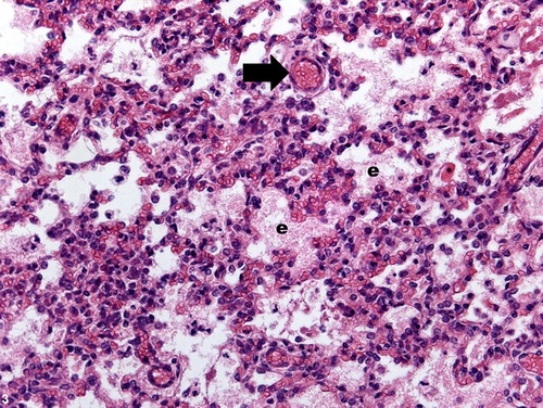 Figure 3. Pulmonary inflammation, cranial lung lobe, ovine. Diffuse and moderate edema (e), irregular alveolar expansion and congestion (arrow). H&E stain; bar = 100 μm.