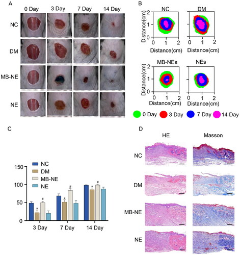 Figure 2. MB-NE promotes wound healing in diabetic mice. (A) Representative wound images of each group of mice at different time points. (B) Wound extent simulations of each group of mice at different time points. (C) Wound healing rate of each group of mice at different time points. (D) HE and Masson staining of wound skin tissue sections of each group of mice on day 14 (n = 5). (E) Wound length analysis (n = 5). Scale bar: 1 mm. NC, control group; DM, diabetic group; MB-NE, diabetic + methylene blue nanoemulsion group; NE, diabetic + blank nanoemulsion group. *p < 0.05, vs. NC, #p < 0.05, vs. DM.