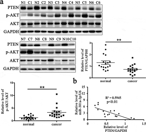 Figure 5. The relative protein level of PTEN is reduced in ESCC tissues.