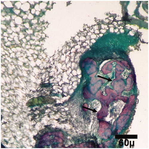 Figure 9. Microscopic section from the healing site of TCP-collagen-treated group on day 45 of healing. The defect is filled with lamellar (arrows) bones (trichrom ×100).