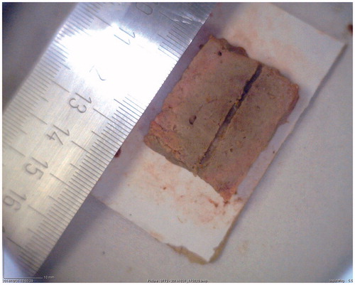 Figure 4. Appearance of a tissue specimen after the RF heating procedure was conducted supplying 70 W at 450 kHz for 7 min.