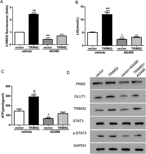 Figure 6. AG490 plays a role opposite to that of TRIM52 in regulating glucose metabolism in OVCAR3 cells. (A) Glucose uptake was analyzed by measuring the level of 2-NBDG. (B–C) Lactate and ATP production were measured. (D) Western blot was used to quantify the protein levels of TRIM52, GLUT1, PKM2, p-STAT3, and STAT3. **P < 0.01 vs. vector, ***P < 0.001 vs. vector, #P < 0.05 vs. TRIM52+AG490, ##P < 0.01 vs. TRIM52+AG490, ###P < 0.001 vs. TRIM52 + AG490.