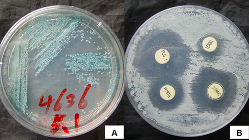 Figure 2 Microbiological examination of CMC. (A) CHROMagar chromogenic medium showed green colonies, which were uplifted, moist, smooth, and pearly. (B) The drug sensitivity test identified sensitivity to itraconazole, nystatin, and 5-fluorocytosine and moderate sensitivity to terbinafine.