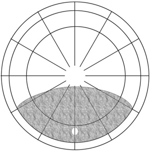 Figure 6 Group 4: symmetrical detachments.