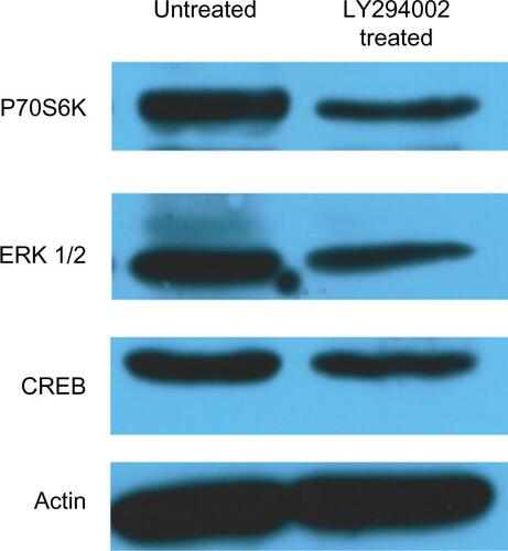 Figure S2 Validation of modulation of signal transduction molecules expression by WB.Notes: U87 cell lysates, from untreated cells and cells treated with PI3K inhibitor LY294002 were analyzed by WB. Expression levels of P70S6K, ERK 1/2, and CREB were specifically detected. Depletion of protein expression for each molecule was demonstrated in treated cells. Actin was used as a loading control. U87 cells were grown with vehicle (1/400 DMSO – untreated cells) or 25 μM PI3K inhibitor (LY294002) for 24 hours, lysed, and the same amount of protein was loaded on a 10% SDS-PAGE gel, transferred onto a nitrocellulose membrane, and examined for total protein expression. Betaactin reblotting was used as loading control. PI3K inhibitor treatment lowered total protein levels for all three investigated proteins.Abbreviations: CREB, cAMP response element-binding protein; DMSO, dimethyl sulfoxide; PI3K, phosphatidylinositol-3′-kinase; WB, Western blot; SDS-PAGE, sodium dodecyl sulfate polyacrylamide gel electrophoresis; ERK, extracellular signal-regulated kinase.