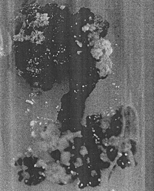 Figure 7 Root explant showing initiation of callus after 15 days in Gamborg's B5 medium supplemented with 2,4-D (2 mg/l) + KIN (0.5 mg/l).