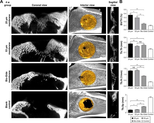 Figure 2 Micro-CT scanning images and analysis results at the end of 4 weeks.Notes: (A) Bone defect models with or without membranes were scanned by micro-CT at 4 weeks postimplantation. In the 25 µm PGS, 53 µm PGS, and Bio-Gide membrane groups, regenerated cancellous bone covered the whole defect site after 4 weeks of implantation. (B) Volume ratios of regenerated bone were evaluated quantitatively in each group. BV/TV, Tb.Th, Tb.N, and Tb.Sp are presented as mean ± SD (*p<0.05, **p<0.01, n=16). At 4 weeks postimplantation, in the 25 µm PGS and 53 µm PGS groups, the volume ratios of newly formed bone were significantly higher than those in the Bio-Gide group and blank control group. “NS” indicates no significant difference among the PGS and Bio-Gide groups (p>0.05, mean ± SD, n=16).Abbreviations: CT, computed tomography; PGS, polyglycerol sebacate; Tb.N, trabecular number; Tb.Sp, trabecular separation; Tb.Th, trabecular thickness; w, week; BV/TV, bone volume to tissue volume.