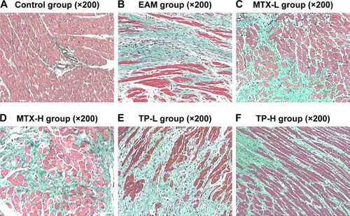 Figure 5 Masson dyeing of myocardium in rats for each group.Notes: (A) In the control group, a small amount of collagen fibers (green) is found around the myocardial cells. (B) In the EAM group, the collagen fibers were of flaky hyperplasia around the muscle bundle and the myocardial cells. (C–F) The area of the myocardial collagen fibers decreased.Abbreviations: EAM, autoimmune myocarditis; H, high dose; L, low dose; MTX, methotrexate; TP, triptolide.