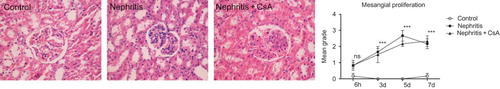 Figure 3.  Mesangial proliferation in rat kidneys during the experimental period and histological appearances of kidneys in control (grade 0, on fifth day), nephritis (grade 4, on fifth day) and nephritis + CsA (grade 3, on fifth day) groups. Values are expressed as mean ± SEM. n = 6 at each time point for each group. Notes: ***Denotes p < 0.001 against control group. ns, not significant against control group. CsA, cyclosporine A.