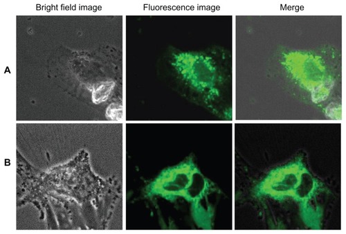 Figure 11 Imaging of (A) human umbilical vein endothelial cells and (B) glioma cells using cadmium sulfide quantum dots after 2 hours of incubation.