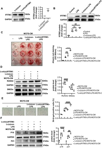 Figure 6. Overexpression of IFITM3 aggravated calcification and senescence of VSMCs. (A) The overexpression of IFITM3 was confirmed by Western blot analysis. n = 3. (B) Western blot analysis was performed to assess the expression of IFITM3 in macrophages subjected to different interventions. n = 3. (C) AR staining and quantification were used to demonstrate that lvsh(o)IFITM3-LPS-MCFS-CM treatment aggravated VSMC calcification compared to LPS-MCFS-CM group. n = 3. (D) The expression of osteogenic markers (RUNX2, SM22α) in VSMCs was determined by Western blot analysis. n = 3. (E) Senescence in VSMCs was assessed by performing SA-β-gal staining and quantifying the percentage of positive cells. n = 3. Scale bar, 50 μm. (F) Western blot analysis was performed to assess the expression of senescent markers (p16 and p21) in VSMCs. n = 3. Data are presented as mean ± SD, two-tailed t-test (a), ***p < 0.001 versus Lv(o)con, one-way ANOVA (B, C, D, E, and F), *p < 0.05, ***p < 0.001, ****p < 0.0001 versus MCFS-CM, # p < 0.05, #### p < 0.0001 versus LPS-MCFS-CM.