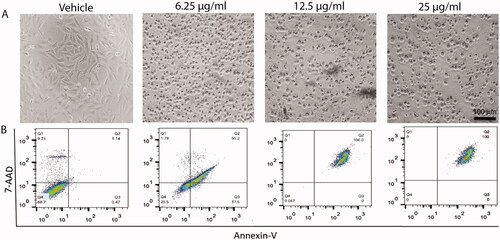 Figure 6. Effect of curcumin nanoparticles on cell apoptosis. Upper panel (A): bright field images showing the effect of different concentrations of cur-NPs (6.25, 12.5 and 25 µg/mL) on HepG2 cells. Lower panel (B): Apoptotic and necrotic cell death of HepG2 were assessed using Annexin V and 7AAD assay after 48 h treatment with curcumin NPs.