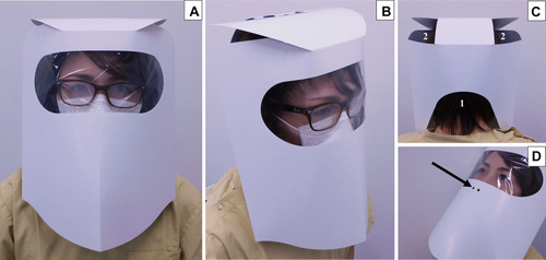 Figure 4 Images of a person wearing Model 2 of the proposed face shield. (A) Front, (B) front oblique, (C) back oblique views. This model completely covers the front part of the head, face, and neck like Model 1 (A, B). However, there are wide openings on the lower half of the back (C-1) and on both sides at the top (C-2), which prevents heat and moisture build-up by allowing air ventilation through the openings. (D) Image of collecting a swab from the nasopharynx of a person wearing Model 2 of the face shield. Nasal swabbing for viral testing (such as polymerase chain reaction testing) can be conducted on a patient wearing the Model 2 shield through pre-cut incisions near the nasal orifices (black arrow). The cotton applicator is inserted through one of these incisions, which are otherwise closed but can be opened easily by applying pressure with a finger to remove the covering. This shield could reduce the clinician’s exposure to droplets from the patient (such as if he or she coughs or sneezes) when collecting the samples.