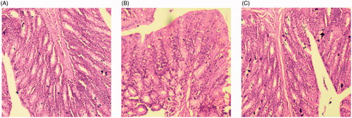 Figure 7. Gastric mucosa irritation study image of (A). Normal saline (B). Thymoquinone suspension (THQ-S) (C). Optimized thymoquinone chitosan-polycaprolactone nanoparticles (THQ-CPLNPs).