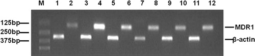 Figure 4. RT-PCR analysis of MDRI gene expression. The sizes of the specific RT-PCR products were 157 bp for MDR1 and 305 bp for β-actin. M: Marker; 1,2: MCF-7 untreated; 3,4: MCF-7/Adr untreated; 5,6: MCF-7/Adr treated with 4 μg/mL EAF; 7,8: MCF-7/Adr treated with 20 μg/mL EAF; 9,10: MCF-7/Adr treated with 4 μg/mL CF; 11,12: MCF-7/Adr treated with 20 μg/mL CF. CF: chloroform fraction; EAF: ethyl acetate fraction.