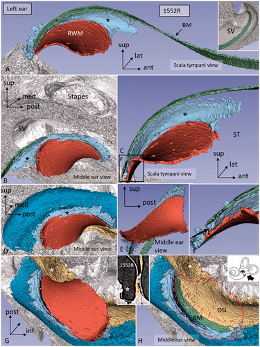 Figure 4. Different angular views of the 3D reconstructed RWM and neighboring soft tissues in a left human ear. A: Infero-medial view shows the relationship between the BM and the SSL (*). B: Same ear viewed from the middle ear displays the relationship between the RWM and stapes. The posterior portion of the RWM lies almost horizontal. C: Infero-medial view of the basal end of the BM and the RWM. Framed area is magnified in F (* = SSL). D: Lateral view of the SL (dark blue) (* = SSL). E: Infero-lateral view with conical shape. F: Magnified framed area in C. The BM is separated from the RWM (arrow). G: Infero-lateral view of the RWM and SL (blue). The close relationship between the SL and RWM is seen. H: Same view as G after removal of RWM (delineated). Inset shows a single SR-PCI section of the medial wall of the round window niche (RWN) (*) and the OSL (yellow). (For abbreviations, see legend to Figure 1).