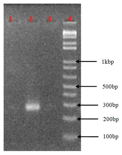 Figure 4 RT-PCR products of jute Ty1-copia and Ty3-gypsy retrotransposons. Lane 1: PCR from isolated RNA only as a control, Lane 2: RT-PCR of Ty1-copia, Lane 3: RT-PCR of Ty3-gypsy. RNA was isolated from the mature leaves of jute variety O-9897.