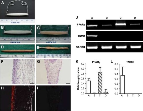 Figure 2 Gross view, histology, and gene expression of neotendon engineered with parallel PGA microfibers and neofat engineered with random PGA microfibers. (A) Setting of in vitro tissue culture with PGA microfibers, which were set on a U-shaped spring with constant strain to form parallel-aligned scaffold fibers. (B) The gross view of the scaffold. (C) The gross view of cell–scaffold construct at 2 hours post–cell seeding. (D) Gross view of neotendon engineered with parallel microfibers for 8 weeks. (E) Gross view of neofat engineered with random microfibers for 8 weeks. (F and H) H&E staining and polarizing light examination of neotendon engineered with parallel microfibers for 8 weeks (100×, bar =100 µm). (G and I) H&E staining and polarizing light examination of neofat engineered with random-patterned microfibers for 8 weeks (100×, bar =100 µm). (J) The gene expression of PPARγ and TNMD of the neo tissues post-8 weeks of culture. (K) Semi-quantification of the gene expression of PPARγ. (L) Semi-quantification of the gene expression of TNMD. In the pictures of J, K, and L, A, B, C, and D, respectively, represent neotendon and cells detached from parallel microfibers after seeding and grew on the culture dishes; and neofat and cells detached from unparallel microfibers after seeding and grew on the culture dishes.Abbreviations: GAPDH, glyceraldehyde-3-phosphate dehydrogenase; H&E, hematoxylin and eosin; PGA, polyglycolic acid; PPARγ, peroxisome proliferator-activated receptor-γ; TNMD, tenomodulin.