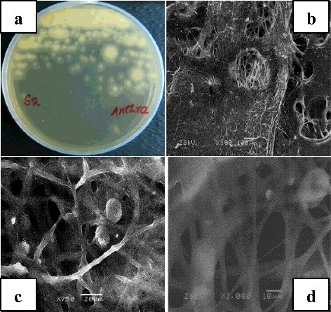 Figure 1. Morphological characteristics of Aspergillus oryzae (Y2). Fungal isolate from Yanbu soil on nutrient agar plate (a); SEM image of isolate Y2 at 100× magnification (b), 750× magnification (c) and 1000× magnification (d).