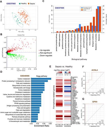 Figure 1 Transcriptomics analysis of metabolism-related genes and ferroptosis-related genes in septic patients. (A) Principal component analysis between healthy and sepsis group of GSE57065. (B) Volcano plot of differentially expressed metabolism-related genes of GSE57065. (C) Biological pathways of differentially expressed metabolism-related genes were analyzed by Funrich software. (D) Kegg pathways of differentially expressed genes between healthy and sepsis group of GSE46955. (E) Heatmap of ferroptosis-related genes between healthy and septic patients. (F) ROC curve of ACSL4. (G) ROC curve of GPX4.