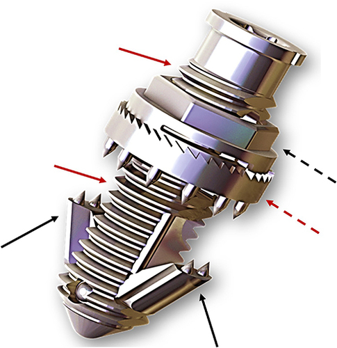 Figure 1 The Minuteman™ interspinous fixation device consists of a central threaded cylinder (solid red arrows) that has two deployable, spiked wings (solid black arrows) hinged near its distal end, and a multi-spiked end cap plate (dashed red arrow) that is located at the proximal side of the device and is tightened against the superior and inferior spinous processes with a locking hex nut (dashed black arrow). Compression between the spiked deployable wings and spiked end cap plate, in conjunction with bone graft material placed in the body of the device, resists motion of the spinous processes and facilitates fusion. The device is placed via a minimally invasive lateral approach.