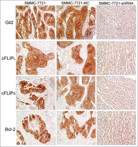 Figure 4. Immunohistochemistry analysis of Gli2 and related protein in tumor tissues in nude mice in the different groups. The results are representative of sections obtained from 5 tumors in the same group. Magnification × 100.