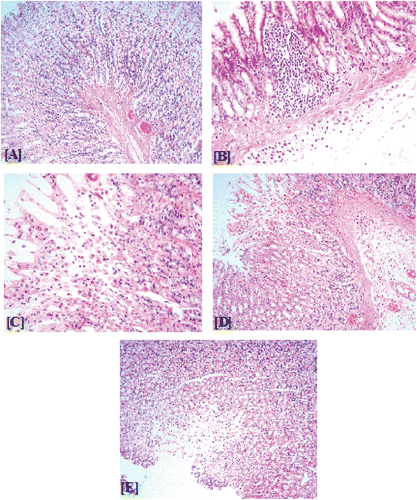 Figure 5.  Histological examination of gastric mucosal sections in control and experimental rats. (A) Section of gastric mucosa obtained from normal rats, (B) section of gastric mucosa obtained from 80% ethanol-treated rat,(C), (D) and (E) sections of gastric mucosa obtained from 80% ethanol-treated rat after pretreatment of Gymnema sylvestre at 100, 200 and 400 mg/kg body weight, respectively.