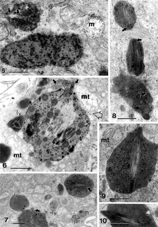 Figures 5–10 Gallery of intracellular, complex lipid inclusions in cholecystitic epithelial cells containing small to large needle-like uncontrasted structures (curved arrows). Open arrows in Figure 6 show associated edges of mitochondria (mt) with lipid complex; m, mucous vesicle; mt, mitochondrion. Scale bar equals 1 μm for all micrographs.
