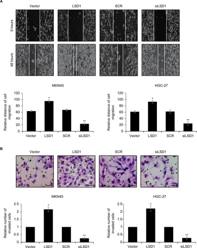 Figure 3 Upregulation of LSD1 promotes GC cell migration and invasion in vitro.Notes: (A) LSD1 was overexpressed or knocked down in MKN-45 and HGC-27 cells. Representative images were captured at 0 and 24 hours to assess the cell migration into the wound space (magnification ×20). *P<0.05, vs vector, **P<0.05, vs SCR. (B) MKN-45 and HGC-27 cells were transfected with pcDNA3.1-LSD1 plasmid or LSD1 siRNA, respectively. After transfection for 48 hours, Transwell invasion assay was performed. Representative images of the Transwell invasion assay following incubation for 24 hours (magnification ×20). Scar bar =250 μm. *P<0.05, vs vector, **P<0.05, vs SCR.Abbreviations: GC, gastric cancer; LSD1, lysine-specific demethylase 1.