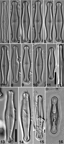 Figs 1–16. Light micrographs of Envekadea (Navicula) hedinii. Figs 1–11. Valve views of specimens from Lake Vrana (Croatia). Fig. 12. Girdle view of specimen from Lake Vrana (Cr.). Figs 13–15. Valve views of the type population from Mapiek Köll (eastern Turkestan). Fig. 16. Valve view of specimen (Croatian population) showing the chloroplast structure. Scale bars: 10 µm.