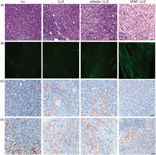 Figure 4. LL/2 tumour sections were harvested from C57BL/6J mice that were immunized once a week for three weeks after the tumour cell injection. (A, B) H&E staining and the TUNEL assay of tumour tissues. Tumour sections from mice treated with hFAP-LL/2 showed more lymphocytes and apoptotic cancer cells than those in the control groups. Scale bar, 100 µm. (C, D) Expression of FAPα and α-SMA within tumours from mice immunized with hFAP-LL/2, pVector-LL/2, LL/2 and normal saline. Scale bar, 100 µm.