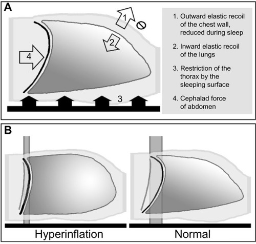 Figure 3 Thoracic physiology during supine sleep.