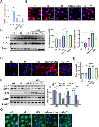 Figure 5 MiR-204-5p inhibitor enhances fibronectin and collagen I expressions and reduces autophagy in HG-treated HK-2 cells. (A) The expression of miR-204-5p was measured using qRT-PCR. (B) FISH was performed to detect the expression of miR-204-5p. (C) The protein levels of FN and COL I were measured using Western blot analysis. (D) The level of FN was measured using immunofluorescence (scale bar = 25μm). (E) The concentration of FN in the culture media of HK-2 cells were evaluated using ELISA. (F) The protein levels of LC3, P62, and ATG5 were measured using Western blot analysis. (G) The level of LC3 was measured using immunofluorescence (scale bar = 25μm). **p < 0.01.