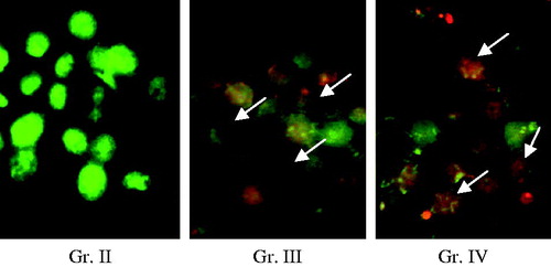 Figure 3. Fluorescence microscopic images of EAT cells from Gr. II (control EAT cells), Gr. III (EAT cells treated with MEZA 100 mg/kg), and Gr. IV (EAT cells treated with MEZA 200 mg/kg) using acridine orange and ethidium bromide. Arrows indicate the formation of apoptotic bodies, condensed nucleus and membrane blebbing as an evidence of MEZA induced apoptosis. Magnification (100×).