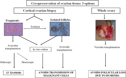 Figure 1. Options for ovarian tissue cryopreservation and reimplantation.