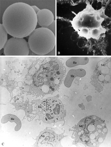 FIG. 3 Ultrastructural characterization of PLGA-microparticle loaded with psoralen A. (A) Representative SEM shows the surface of PLGA microparticle loaded with psoralen A (30000×). (B) PLGA-microparticle (SEM) (→)-phagocited by macrophage cell after incubation for 120 min (5000×). (C) Representative TEM of microparticle in incubation for 120 min peritoneal exudate cell population: neutrophil-Nϕ, eosinophil-Eo, hemacea-He, and selective phagocytose by macrophage-MC (3200×).