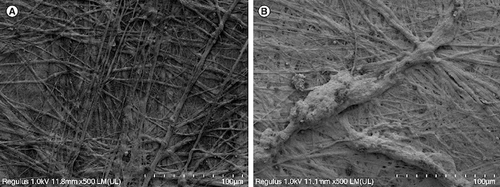 Figure 3. Electron microscopy.(A) Small porcine intestinal submucosa. (B) Human umbilical cord mesenchymal stem cells combined with small porcine intestinal submucosa (scale bar = 100 μm).