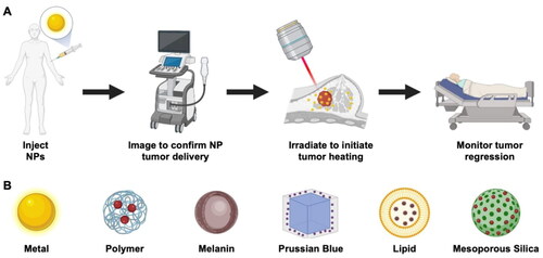 Scheme 1. Overview of theranostic NPs for dual cancer imaging and PTT. (A) Depiction of the process to use NPs for real-time imaging to guide PTT. (B) Summary of various NP formulations that have used pre-clinically as phototheranostics. Red spheres in the polymer, lipid and silica formulations indicate encapsulated light-responsive dyes. Created with BioRender.com.